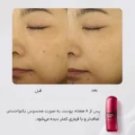 مقایسه قبل و بعد از ۸ هفته مصرف کنسانتره جوانساز شیسیدو اولتیمون | بهبود یکنواختی، صافی و کاهش قرمزی پوست با Shiseido Ultimune Power Infusing Concentrate