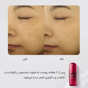 مقایسه قبل و بعد از ۸ هفته مصرف کنسانتره جوانساز شیسیدو اولتیمون | بهبود یکنواختی، صافی و کاهش قرمزی پوست با Shiseido Ultimune Power Infusing Concentrate
