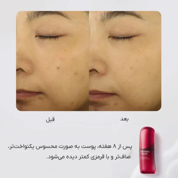 مقایسه قبل و بعد از ۸ هفته مصرف کنسانتره جوانساز شیسیدو اولتیمون | بهبود یکنواختی، صافی و کاهش قرمزی پوست با Shiseido Ultimune Power Infusing Concentrate